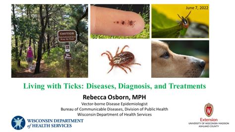 Living With Ticks Ticks And Tick Borne Diseases In Wisconsin Youtube