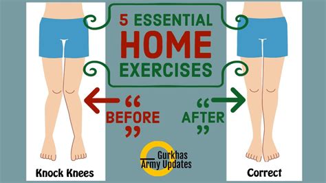 5 Essential Exercises To Cure Knock Knees At Home Make This Lockdown Productive Youtube