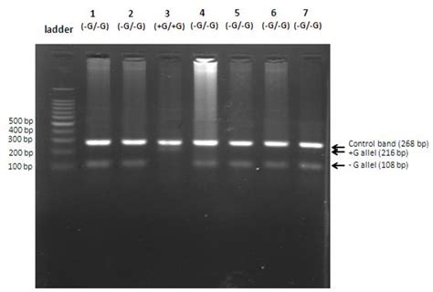 Figure From Tetra Primer Arms Pcr Optimization For Detection Of Ivs