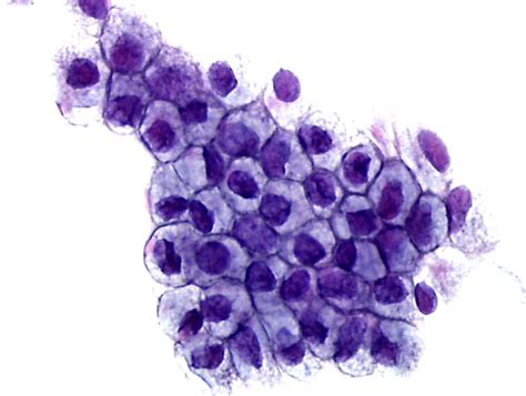 Cytopathology Of The Uterine Cervix Digital Atlas