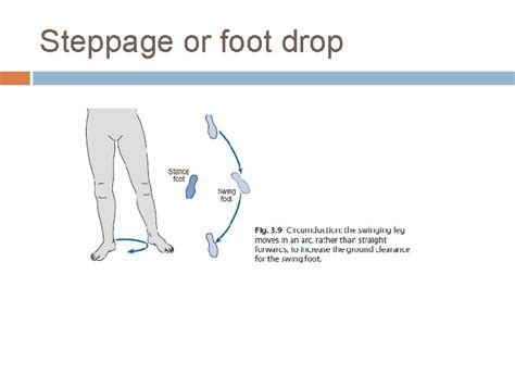 ABNORMAL GAIT Abnormal Gait Syndromes In general gait