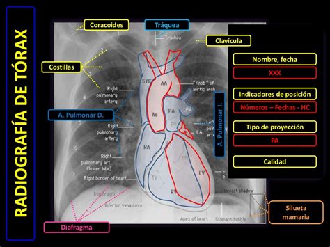 Diagnóstico Por Imágenes Radiografía De Tórax Normal