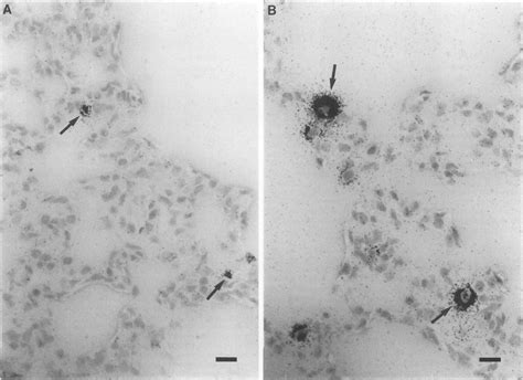 In Situ Hybridization Analysis On The Same Sections As In Fig 3 But At