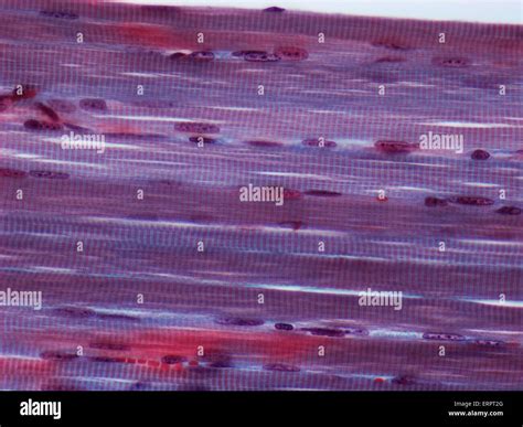 Skeletal Muscle Light Micrograph Of A Longitudinal Section Through