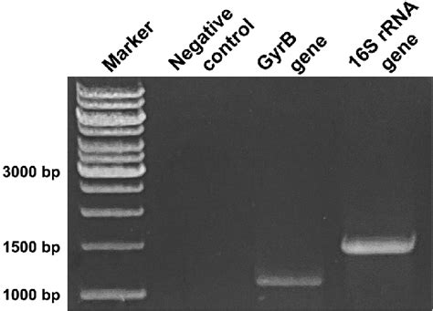 Agarose Gel Electrophoresis Of Pcr Products Of The 16 S Rrna And Gyrb