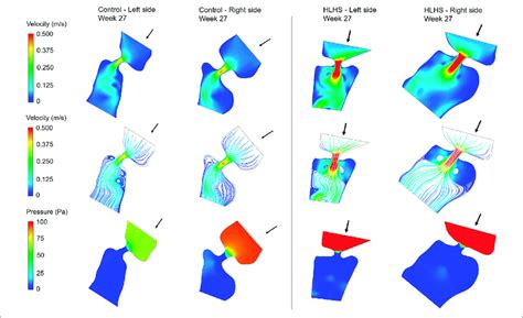 Velocity Contours Flow Streamlines And Pressure Contours At The Download Scientific Diagram