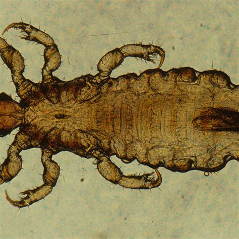 Head Louse Pediculus Humanus Capitis Eth Bibliothek Zürich