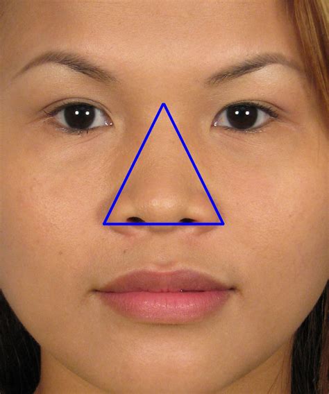 San Diego Asian Rhinoplasty Expert Dr John Hilinski Nose Reshaping