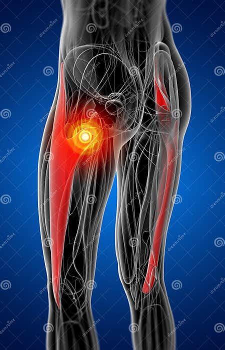 Medical Illustration Of The Tensor Fascia Lata Stock Illustration Illustration Of Human