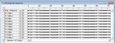 Dmd Exploitation Pédagogique — Site Des Ressources D Acces Pour Enseigner Les Sciences De La