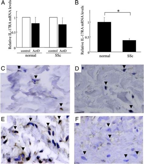 Impaired Il 17 Signaling Pathway Contributes To The Increased Collagen