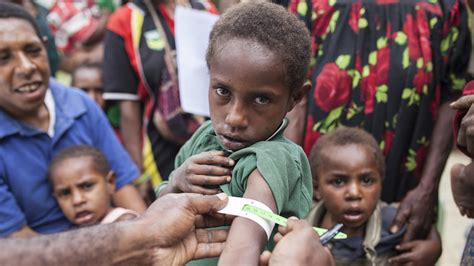 Malnutrition Can Have An Economic Impact Post Courier