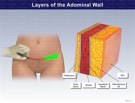 Abdominal Muscles Layers