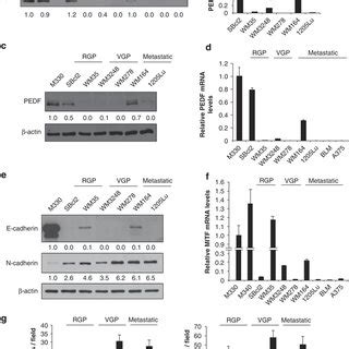 PEDF Expression In Series Of Melanoma Cell Lines From Microarray