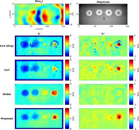 Figure From Robust Mr Elastography Stiffness Quantification Using A