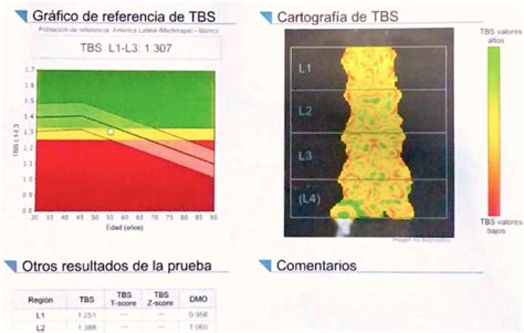 Densitometría Grupo Ct Scanner