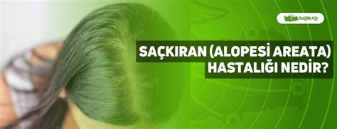 Saçkıran Alopesi Areata Hastalığı Nedir Sağlık Ağı