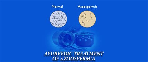 Azoospermia Natural Treatment: Azoospermia Symptom & Causes