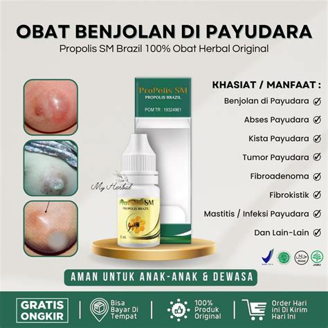 Jual COD Obat Herbal Untuk Benjolan Payudara 100 Asli Alami