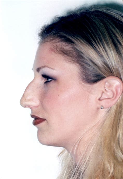 Roman Nose Female