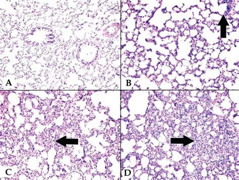 L Carnitine Reduces Acute Lung Injury In Experimental Biliary