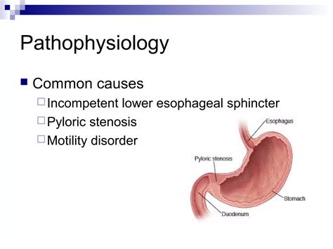 Gastro esophageal reflux disease (GERD) | PPT