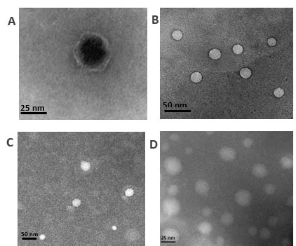 Electron micrographs of MS 2 and ΦX 174 bacteriophage stained with 2