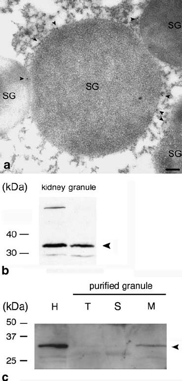 Localization Of AQP6 In The Secretory Granule Membrane Of Rat Parotid