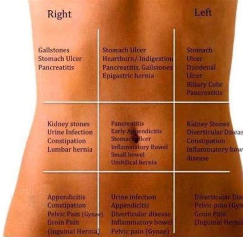 Abdominal Assessment Ems Pinterest