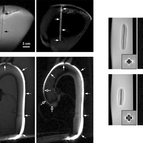 Simulated Phase Cycled Balanced Steady State Free Precession Mri Signal