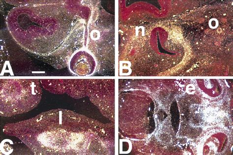 Expression Of The Fkh1 Mf1 Gene In Mouse Embryos At Embryonic Day 12 5