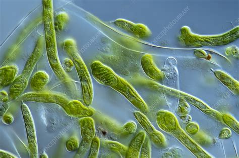 Ophiocytium Algae Light Micrograph Stock Image C0577944 Science