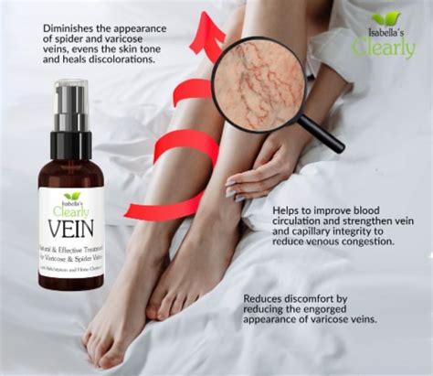 Clearly Vein Varicose And Spider Vein Treatment 2 Fl Oz Smith’s Food And Drug