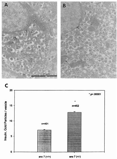 Electron Microscopy Immunogold Labeling Of Insulin In Control A And