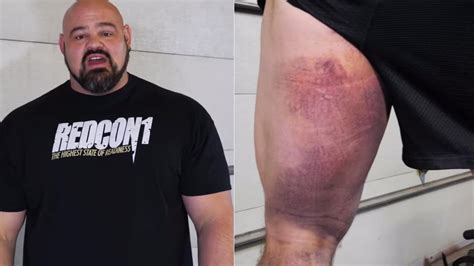 Brian Shaw Updates Fans On Hamstring Injury From 2019 Arnold Classic