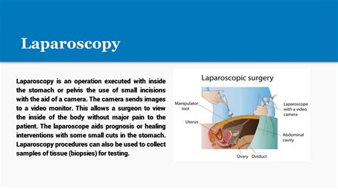 Ppt Laparoscopy Surgery And Treatments Powerpoint Presentation Free