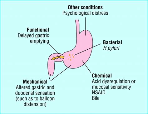 indigestion    functional  bmj