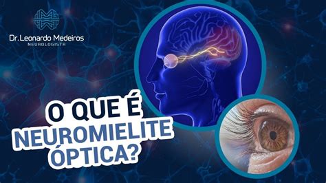 NEUROMIELITE ÓPTICA Tudo o que você precisa saber YouTube