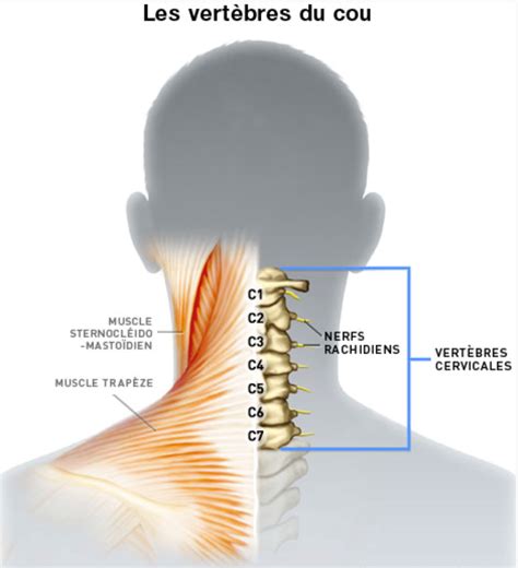 Canal Cervical Troit Chirurgie Orthop Dique