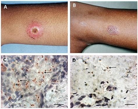 Frontiers Leishmania Spp Host Interaction There Is Always An Onset