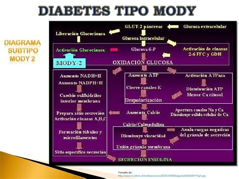 Diabetes Tipo Mody Taller 4