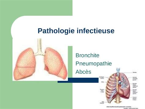 PPT Pathologie infectieuse Bronchite Pneumopathie Abcès DOKUMEN TIPS