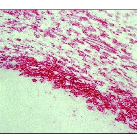 Pdf Caseous Lymphadenitis In Sheep And Goats