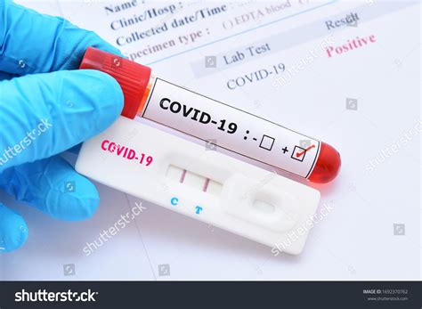 33,795 Covid 19 Positive Test Images, Stock Photos & Vectors | Shutterstock