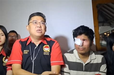 Alvin Lim Siap Tanggung Biaya Pengobatan Agus Salim Farhat Abbas