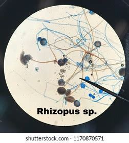 Rhizopus Stolonifer Under Microscope