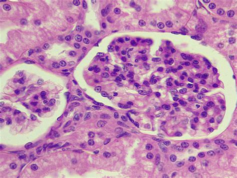 Simple Squamous Epi Kidney Bowmans Capsule 630x P000123 OER Commons