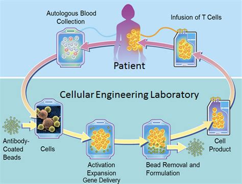 Fda Approves First Car T Cell Therapy For Pediatric Acute Lymphoblastic