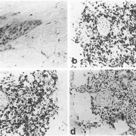 Effect Of A Single Intradermal Injection Of Rlfn Y On T Cell Download Scientific Diagram