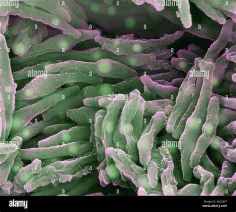 Tuberculosis Bacteria Coloured Scanning Electron Micrograph Of